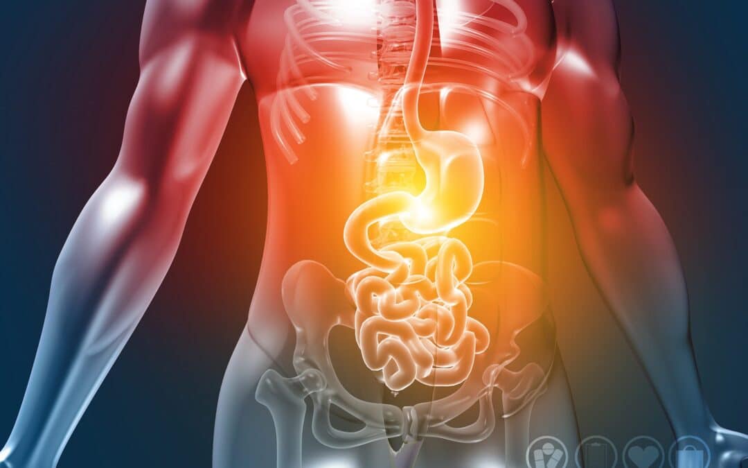 Oorzaken en oplossingen voor colitis ulcerosa en crohn