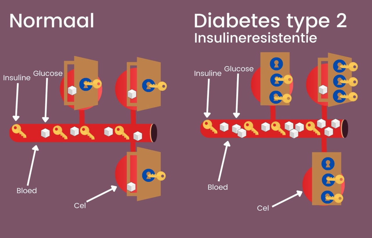 De emotionele oorzaak van Diabetes