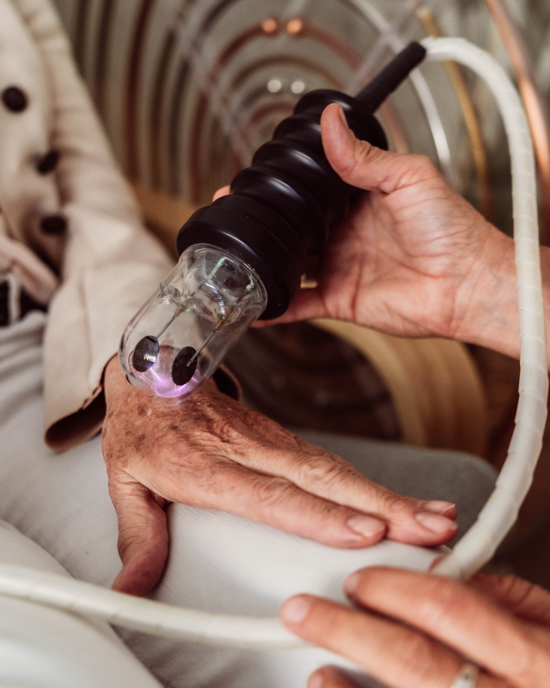plasma violet ray behandeling 